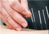 پیشگیری از "دیابت" با استفاده از طب سوزنی