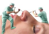 "بلک فرآیدی" تله تبلیغاتی کلینیک‌های زیبایی برای جذب مشتری/ خطر خدمات زیبایی پرتخفیف