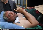 انتقال مجروحان حادثه تروریستی یمن به بیمارستان بقیه الله الاعظم تهران