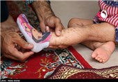 این بیماری باعث خشکی سوزش و خارش پوست میشود و ملیکا جزو 8نفری است که درکشور مبتلا به این بیماری نادر است.ایکتیوز جزو بیماریهایی است که درمان آن هزینه بالایی دارد.