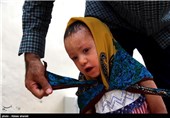 ملیکا دختر 2ساله ایست که  از بدو تولد مبتلا به بیماری ایکتیوز می باشد.