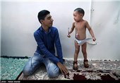 ملیکا دختر 2ساله ایست که  از بدو تولد مبتلا به بیماری ایکتیوز می باشد.این بیماری باعث خشکی سوزش و خارش پوست میشود و ملیکا جزو 8نفری است که درکشور مبتلا به این بیماری نادر است.ایکتیوز جزو بیماریهایی است که درمان آن هزینه بالایی دارد.