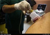 دشمنی آشکار با "حجامت" این بار با ادعاهای غیرعلمی رئیس سازمان انتقال خون