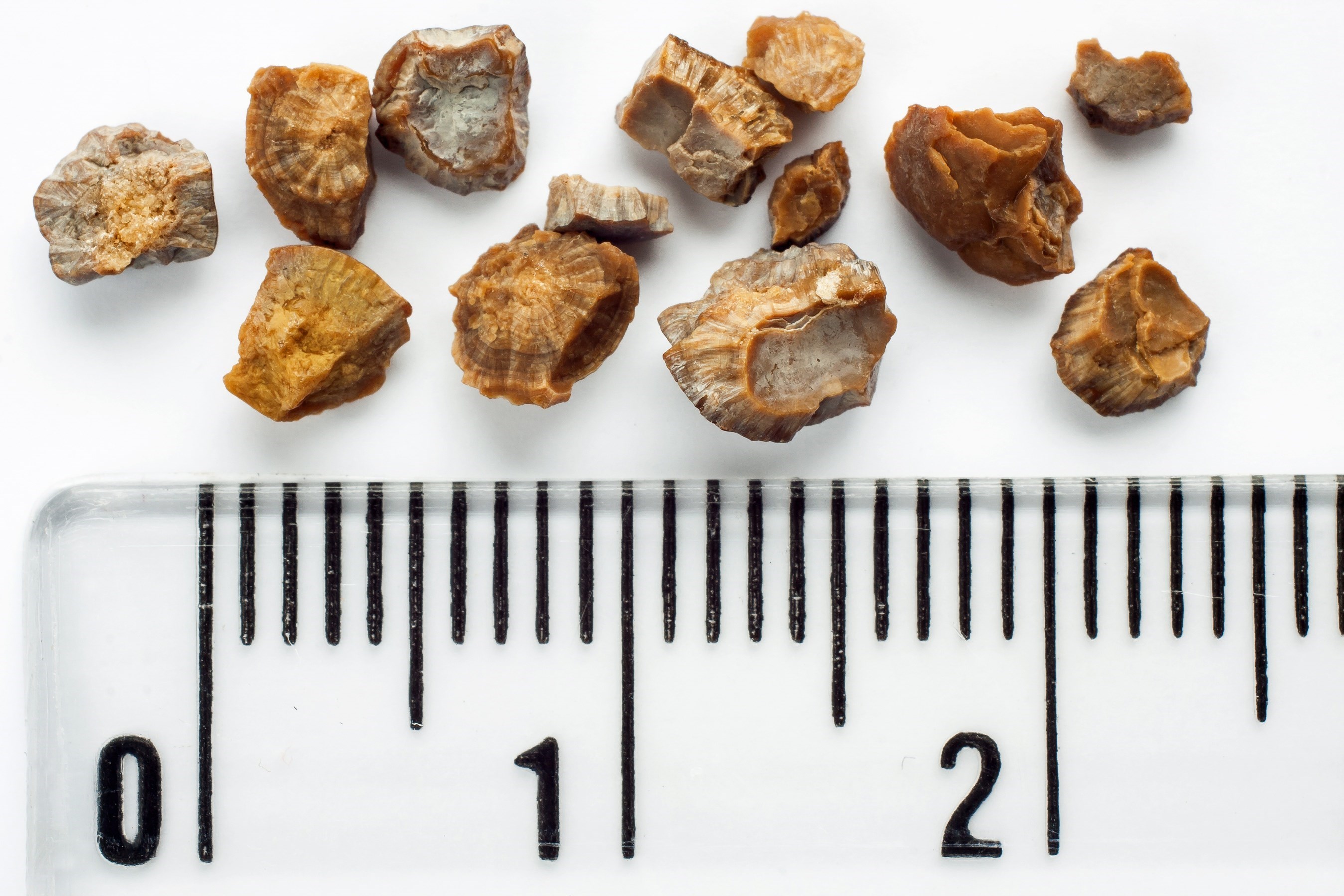 طب سنتی , 