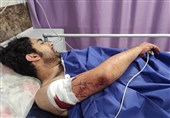 روایت تکان‌دهنده عکاس خبری ربوده شده از تحمل 21 ضربه چاقو و از دست دادن 200 میلیون تجهیزات/ ادوات دفاعی برای عکاسان لازم است