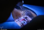 ردپای یک پزشک و مقام سابق مشهور در انجام جراحی ممنوعه/ اعزام بیماران از ایران به عمان برای تغییر رنگ چشم