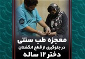معجزه طب سنتی در جلوگیری از قطع انگشتان دختر 12 ساله