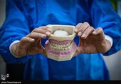 دانش‌آموزان دبستانی به طور میانگین 5 دندان پوسیده دارند/اجرای پویش سلامت دهان از هفته آینده