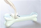 ابتلای بسیاری از سالمندان ایرانی به پوکی استخوان