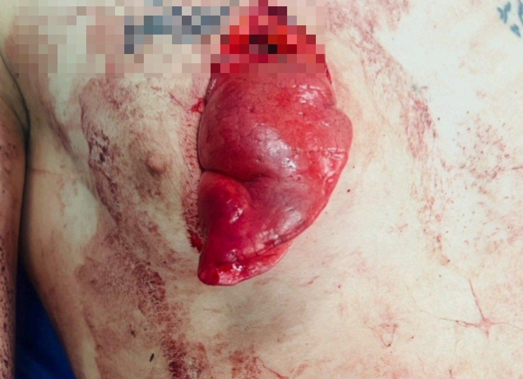 اخبار ورامین , اخبار استان تهران , اتاق عمل جراحی , 