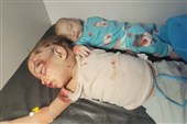 الیمن: 6 شهداء بینهم طفلان فی غارات سعودیة على المخا.. وقصف صاروخی غربی صعدة