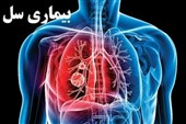 ایران به سمت پیش‌حذف «سل» حرکت می‌کند